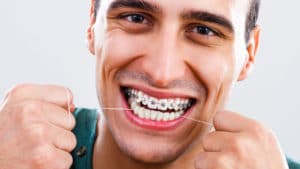 Brushing and flossing with braces
