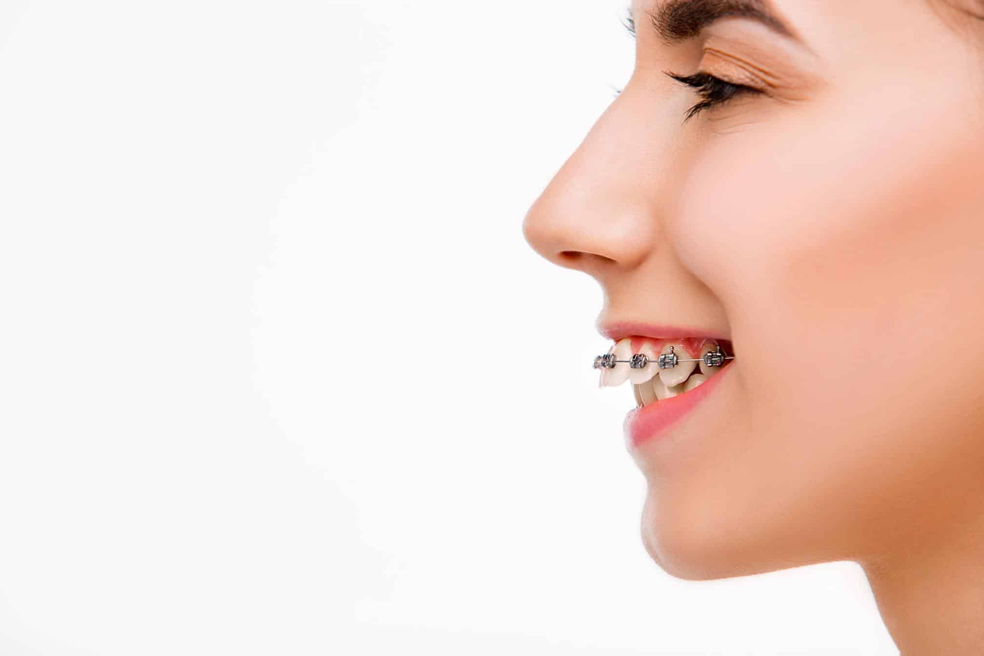 Common Orthodontic Issues and Their Treatment Options Family Braces