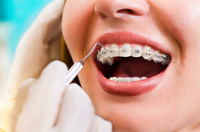 The History of Orthodontic & Braces - Family Braces