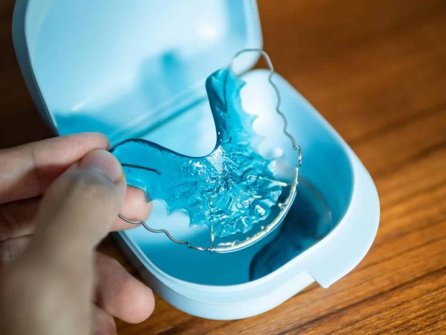 Why a retainer is important to maintain your orthodontic work