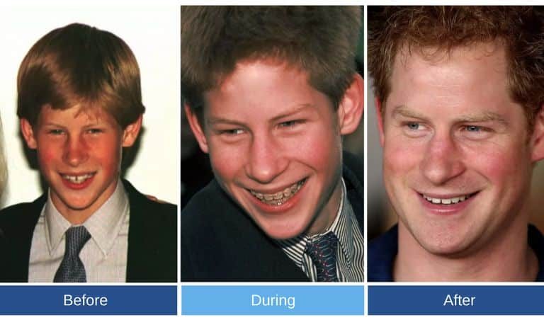 Prince Harry